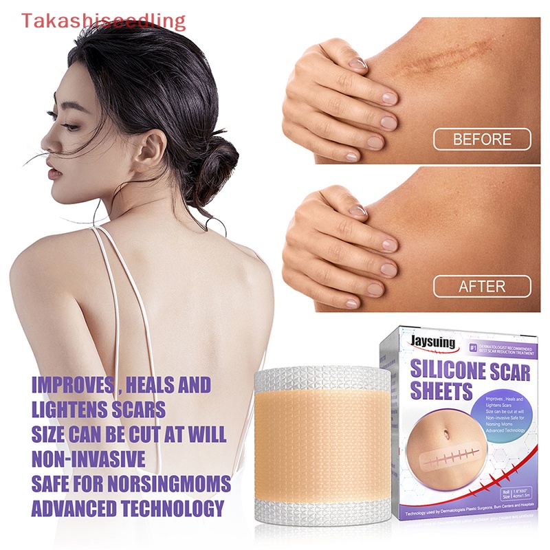 Miếng Dán Silicone Hỗ trợ giảm sẹo Tái Sử Dụng Tiện Lợi 4x150cm