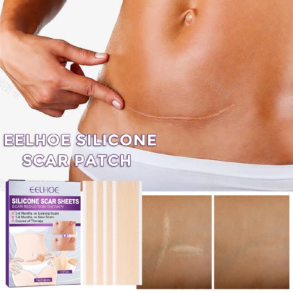 Silicone Scar Sheets Invisible Surgical Scar Removal Tape Scar Removal Treatment