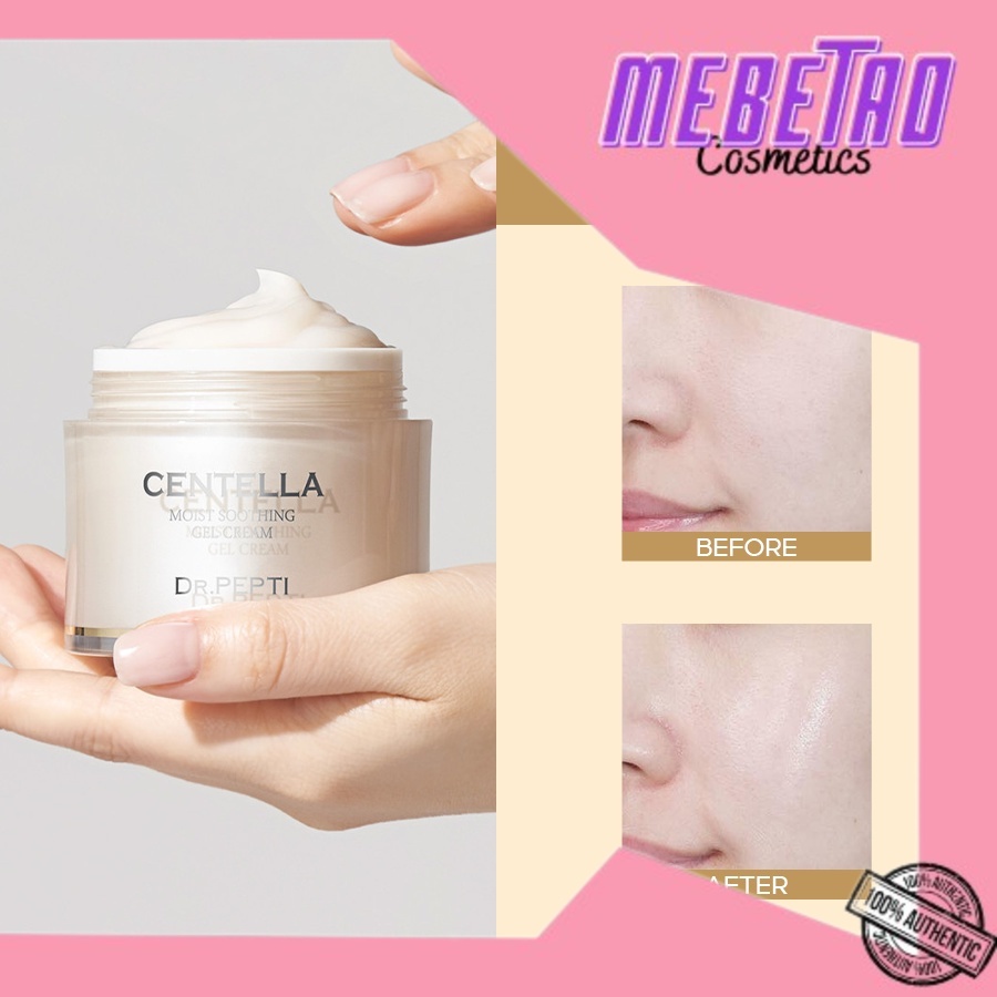 Kem Dưỡng Ẩm Chiết Xuất Rau Má Làm Dịu Da Dr.Pepti Centella Moist Soothing Gel Cream 70ml