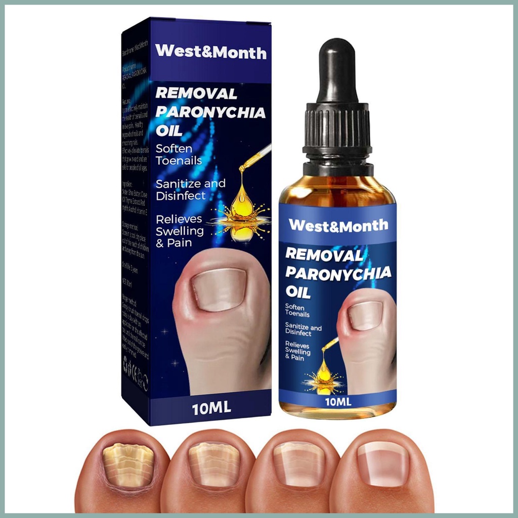 Tinh Chất Hỗ Trợ Điều Chỉnh Móng Chân Mọc Ngược Tự Nhiên 10ml