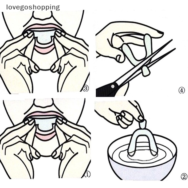Set 4 Dụng Cụ Bảo Vệ Miệng Bằng Silicon Tiện Dụng