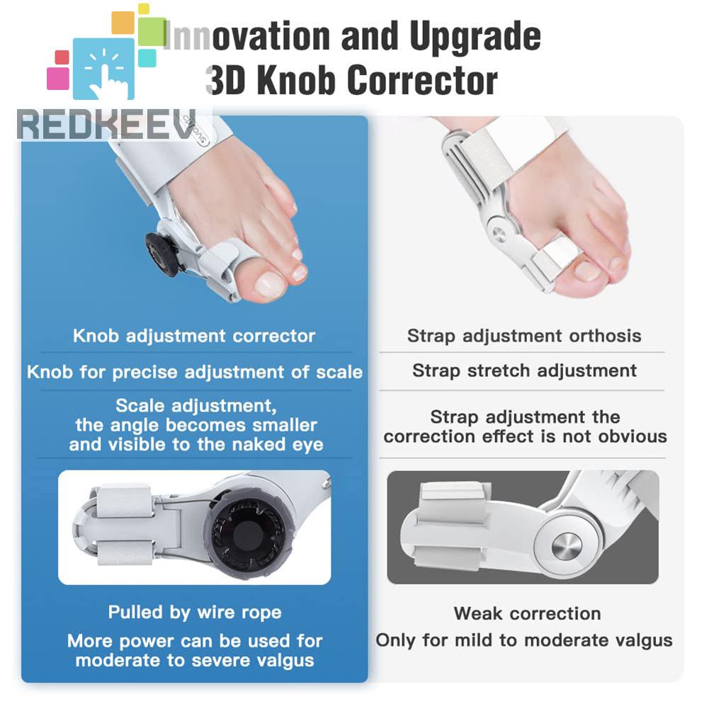 Dụng Cụ Nẹp Điều Chỉnh Tư Thế Ngón Chân Cái Bunion