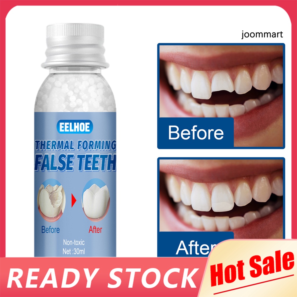 Keo Dán Hạt Nhựa PE Tạm Thời 30ML Chuyên Dụng Cho Răng Tạm Thời