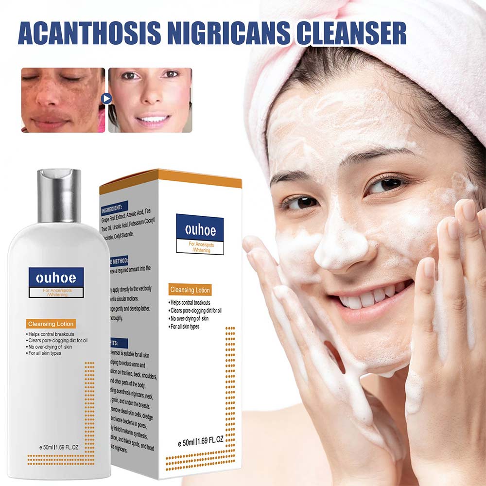 50ml Cleansing Lotion Moisturizing Relieving Dry Skin Facial Exfoliation Lighten Dark Pigmentation Facial Cleanser