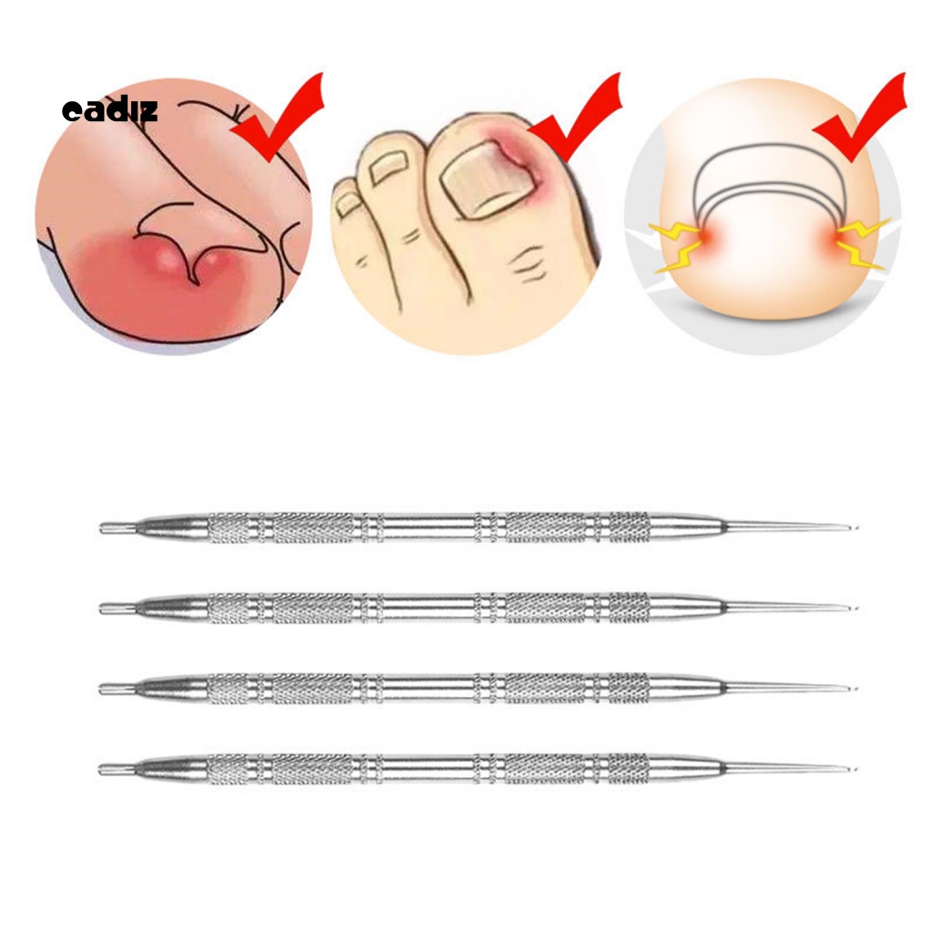 Dụng Cụ Loại Bỏ Da Chết Ở Móng Tay Bằng Thép Không Gỉ