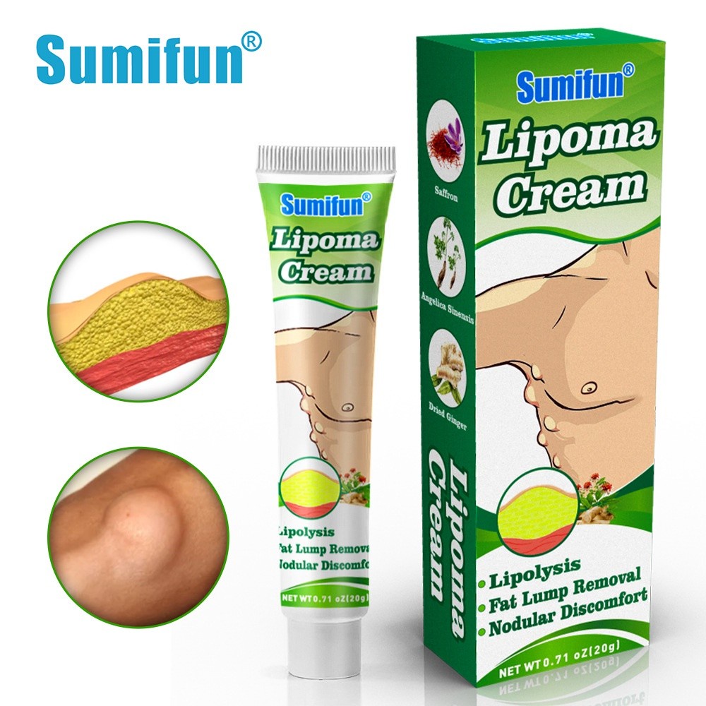 Kem Loại Bỏ Lipoma, Kem Lipoma Loại Bỏ Nhiều Loại Bỏ Dưới Da Đơn Khối Phồng Loại Bỏ Lipoma Nhanh Beautysecret1 beautysecret1