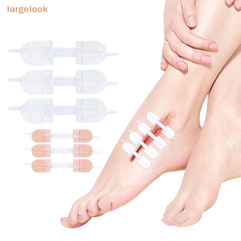 [Biglook] Miếng Vá Vết Thương Có Dây Kéo Tĩnh Điện Nhanh Chóng