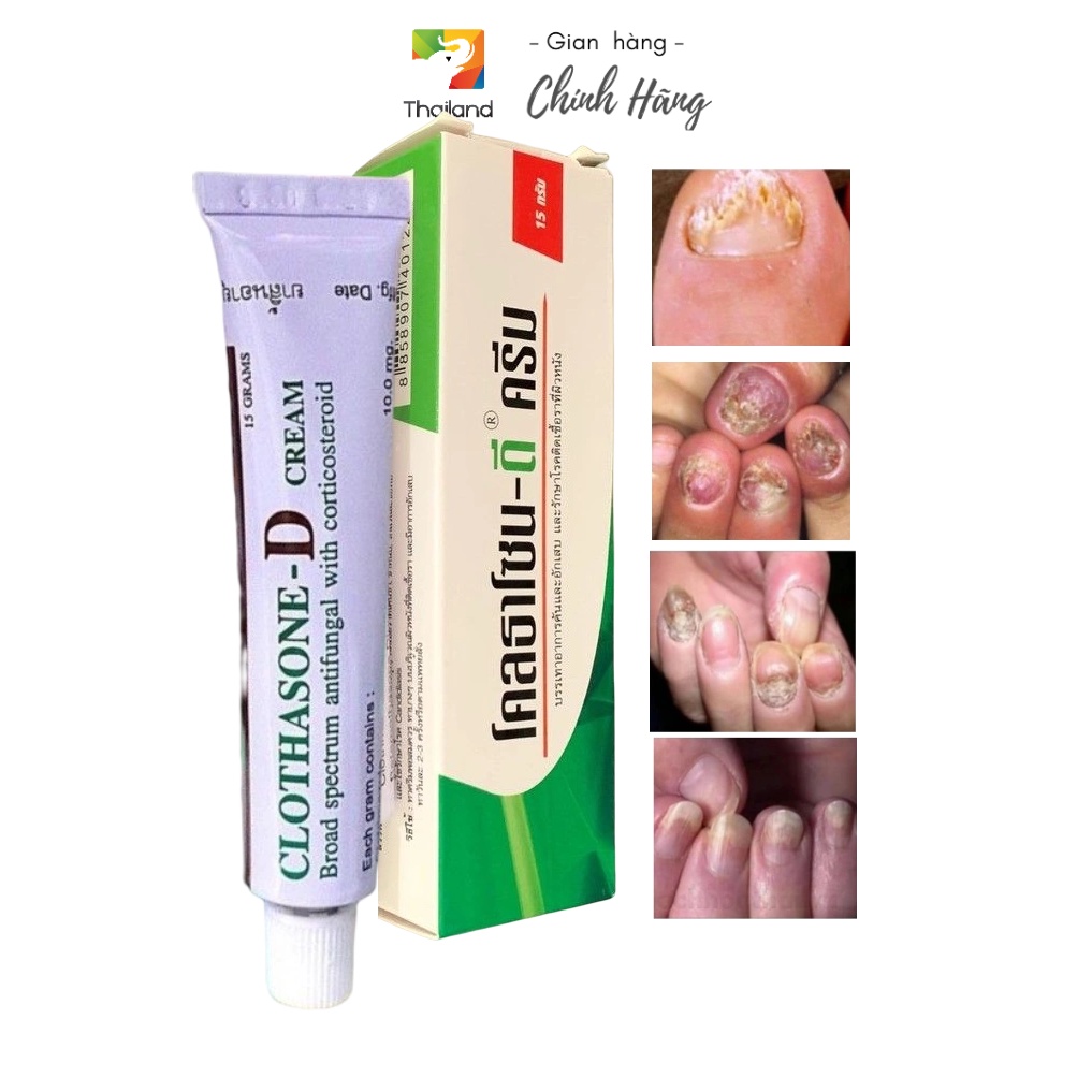 Tuýp 15g Kem nấm móng Clothasone-D Cream Thái Lan