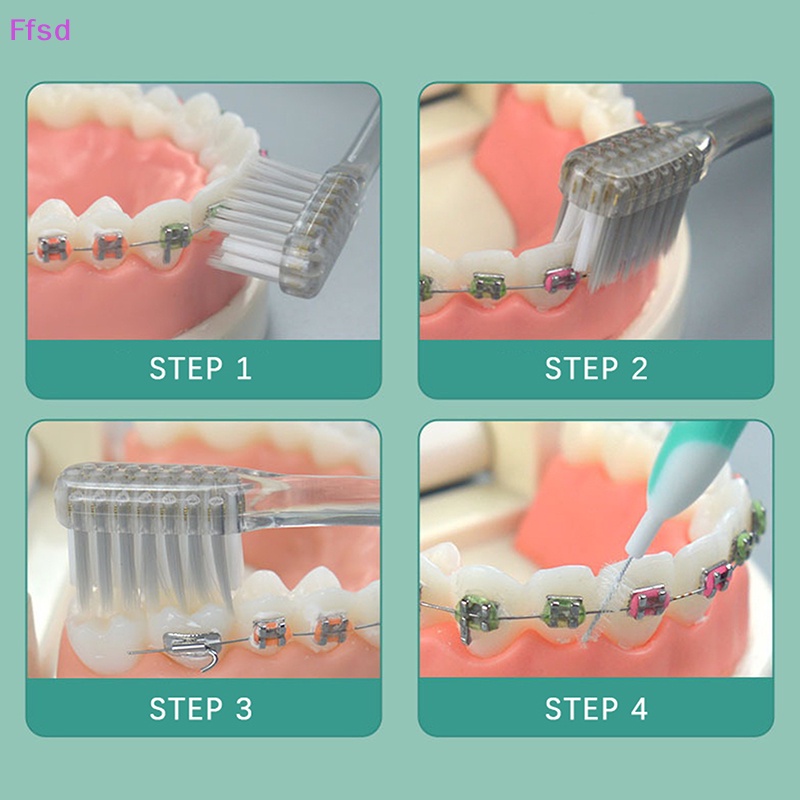 {Ffsd} Bàn Chải Đánh Răng Chỉnh Nha Chăm Sóc Răng Miệng * Bán Chạy