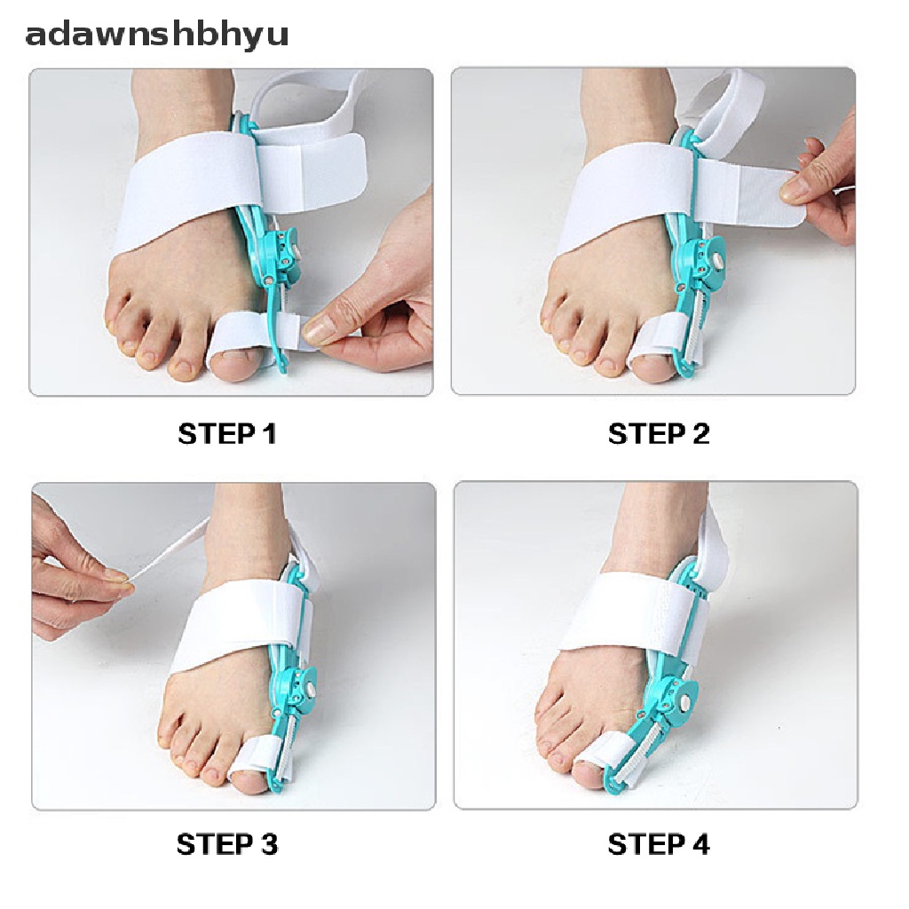 1 Dụng Cụ Nẹp Điều Chỉnh Ngón Chân Cái Bunion