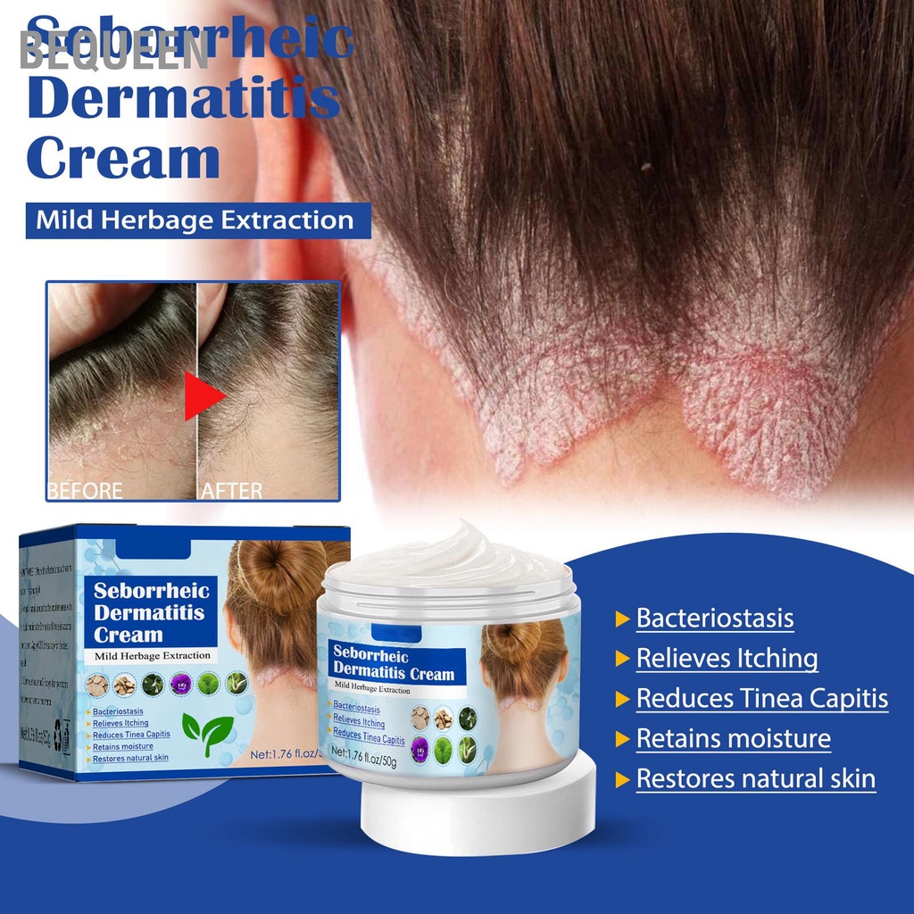 Bequeen 2 Chiếc 1.8Oz Kem Trị Viêm Da Tiết Bã Làm Dịu Giảm Gàu Ngứa Nhẹ Đầu Điều