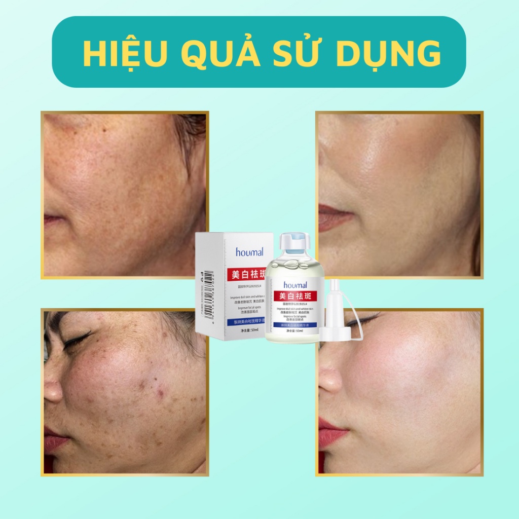Tinh Chất Nicotinamide Giúp Làm Trắng Và Sáng Da