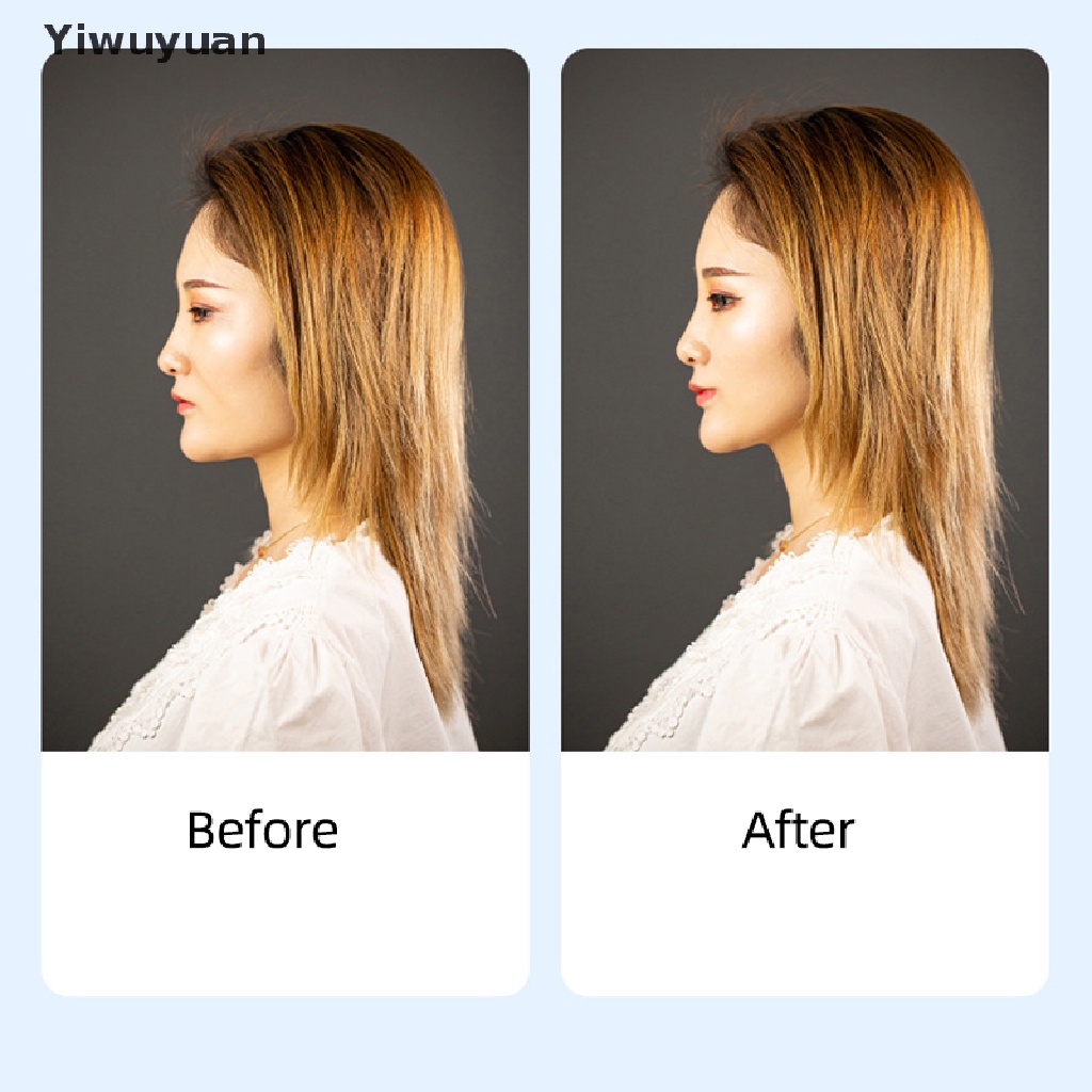 < Yiwuyuan > Kẹp Nâng Mặt Vô Hình Loại Bỏ Tóc Đuôi Cá Vô Hình