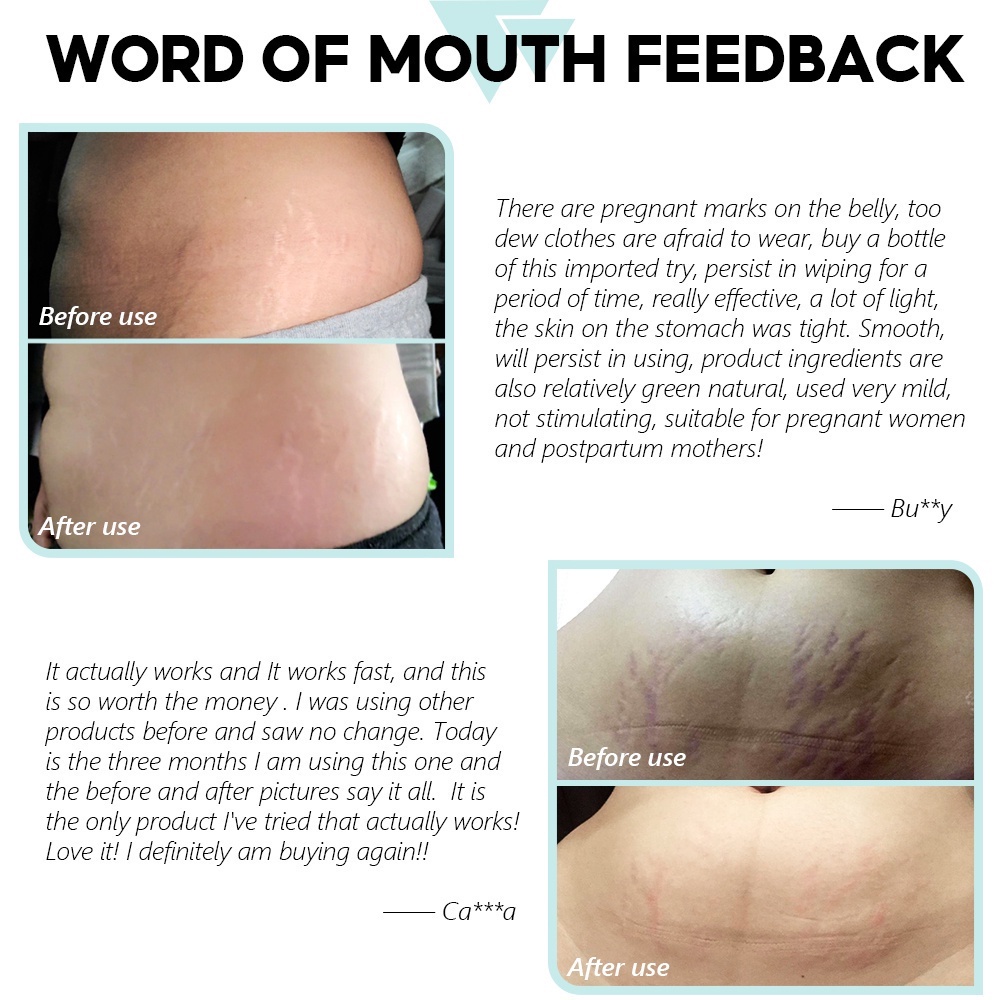 Kem hỗ trợ rạn da sau sinh, chống lão hóa VIBRANT GLAMOUR Treatment Stretch Mark 30g