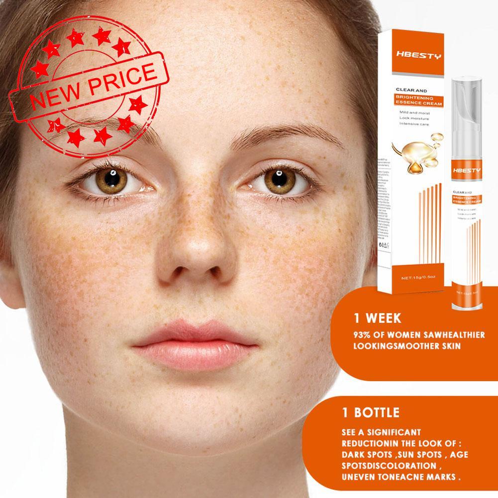 Kem Làm Sáng Da Loại Bỏ Đốm Đen Và Tàn Nhang T2Q5