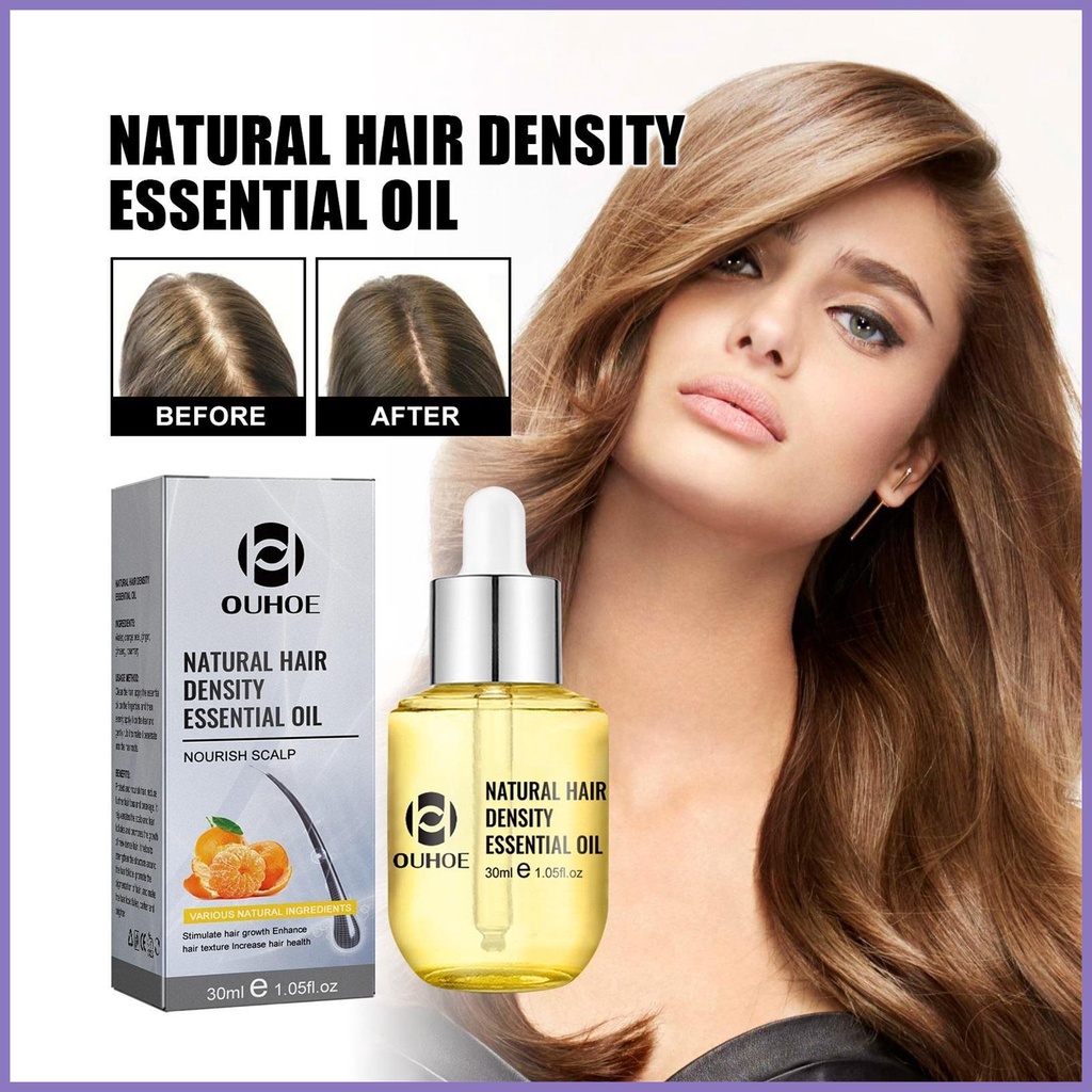 Tinh Chất Kích Thích Mọc Tóc 30ml An Toàn Cho Tóc Dày Hơn Và Rụng Tóc nota2vn