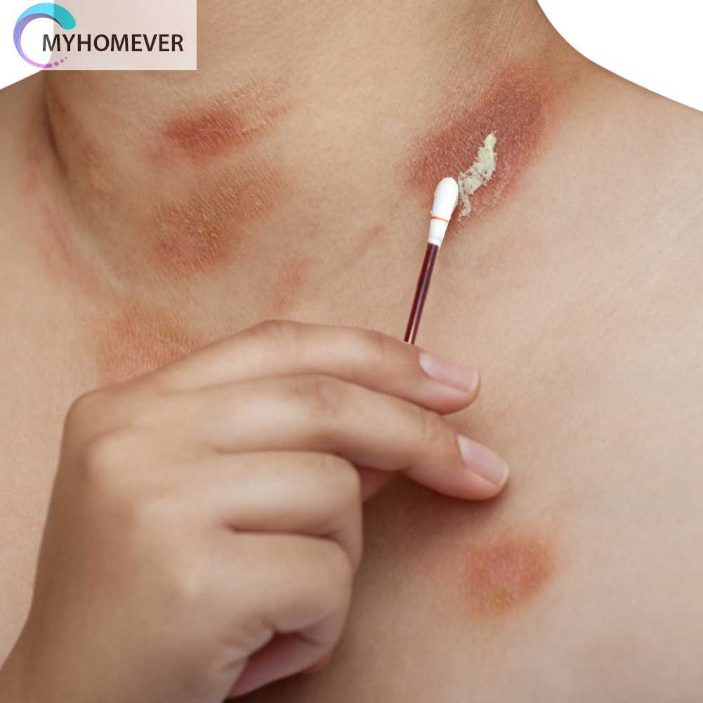 Set 50 / 100 Tăm Bông Y Tế Khử Trùng Dùng Một Lần