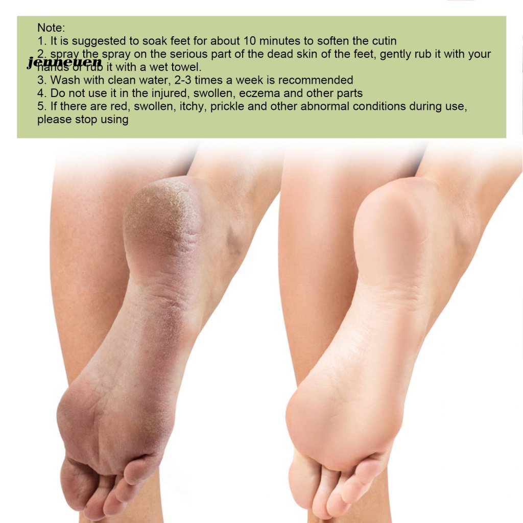 Chai Xịt Tẩy Tế Bào Chết Cho Bàn Chân 100ML Tiện Dụng