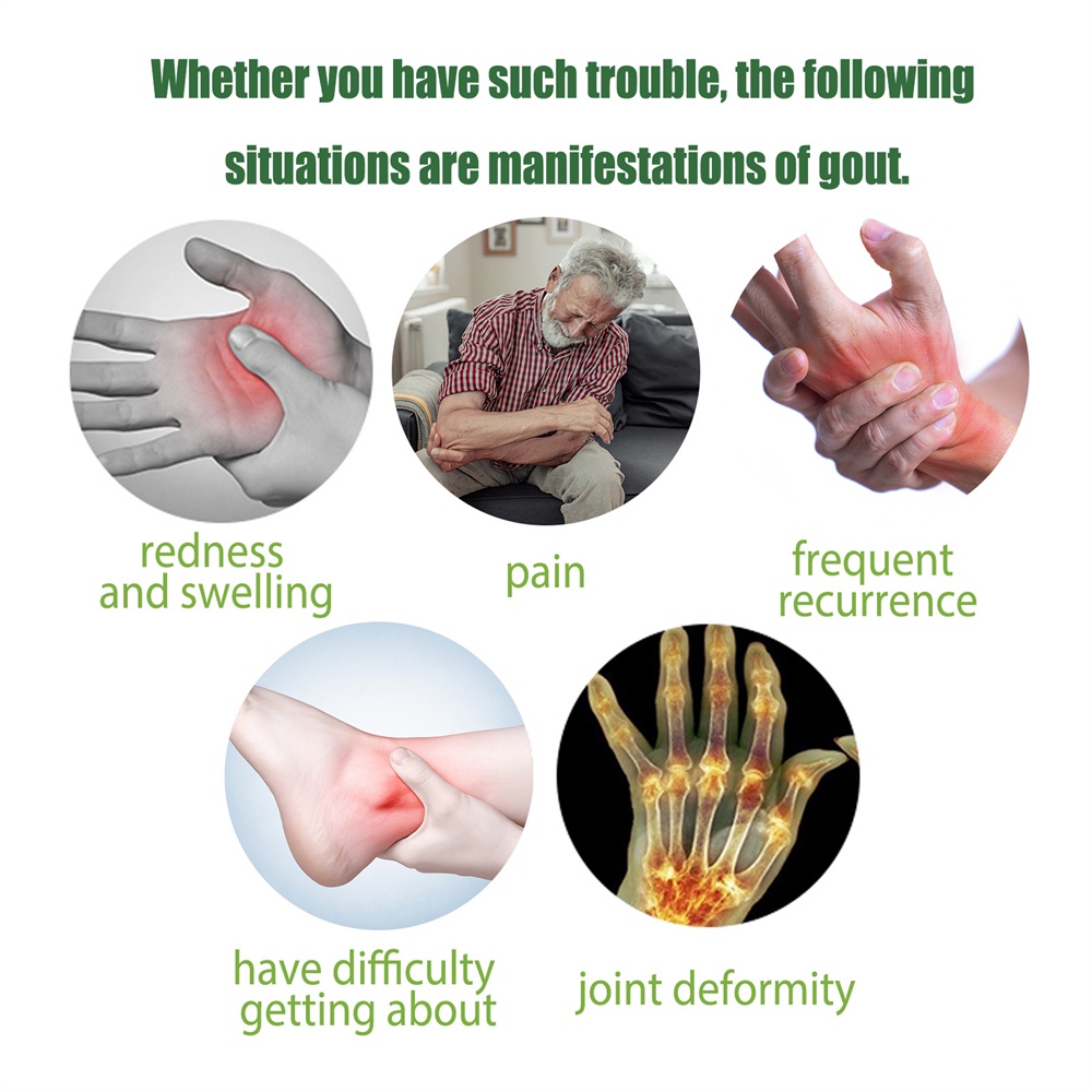 Eelhoe 10 Chiếc Miếng Dán Gout Giảm Viêm Khớp Ngón Tay Cái Cổ Tay Ngón Tay Đau Khớp Khó Chịu Sưng Tự Động Làm Nóng Miếng Dán Chăm Sóc Cơ Thể