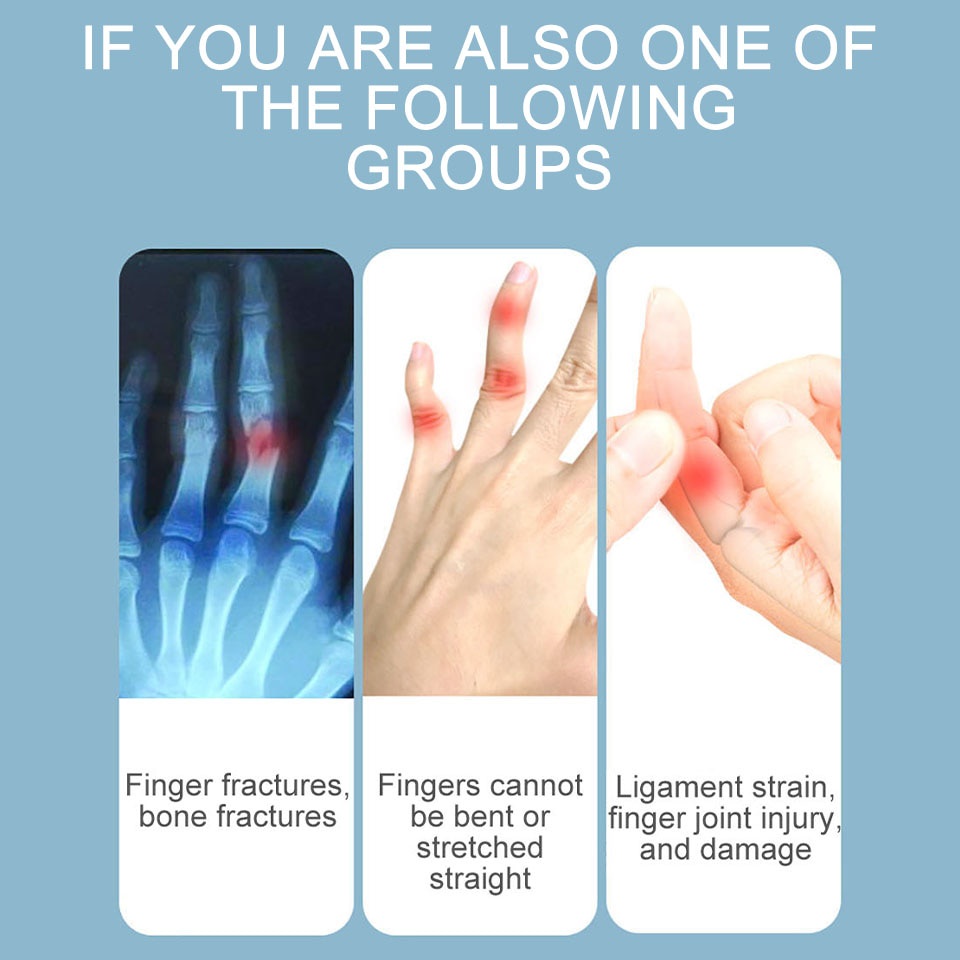Dayselect nẹp cố định ngón tay có thể điều chỉnh làm thẳng nẹp giảm đau kích hoạt bong gân trật khớp gãy xương nẹp ngón tay hỗ trợ chỉnh sửa