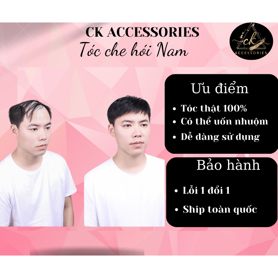 Tóc che hói nam tóc thật