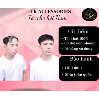 Tóc che hói nam tóc thật