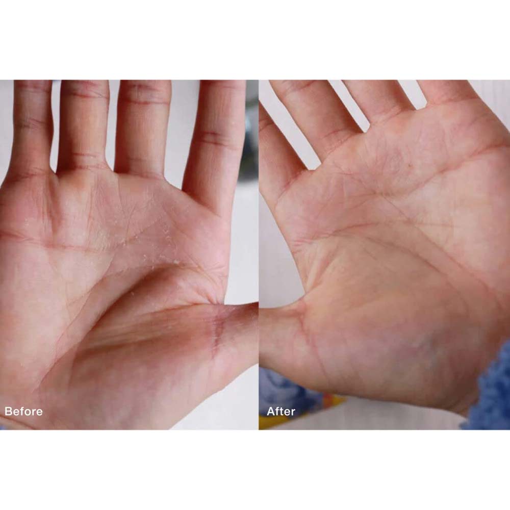 DU'IT Tough Hands Emergency Hand Mask Dead Skin Protection Cream 150g