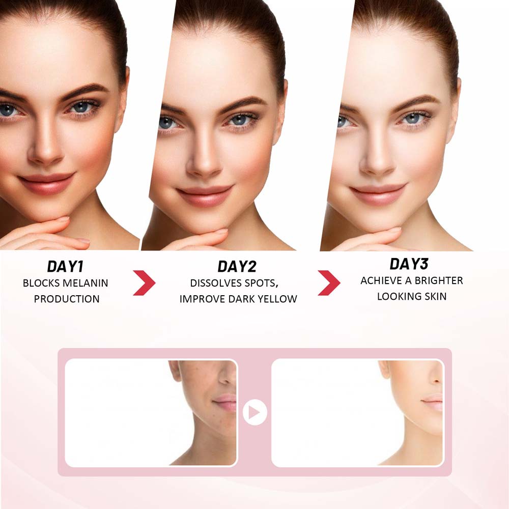 Eelhoe 3 Days Kojic Acid Whitening Moisturizing Cream Black Spot Repairing Cream Body Cream Removing Black Spots Depigmentation Brightening Moisturizing 25g