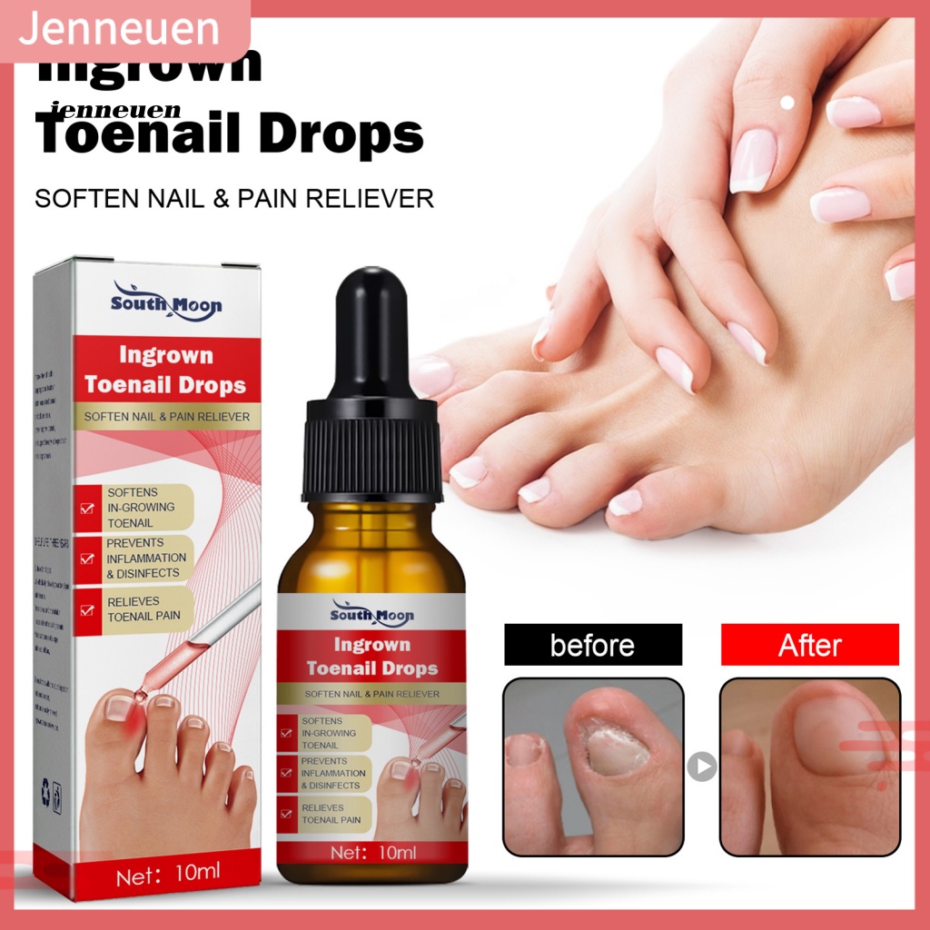 Tinh Chất Dưỡng Móng Tay / Chân 10ml Làm Trắng Không Đau Cho Người Lớn