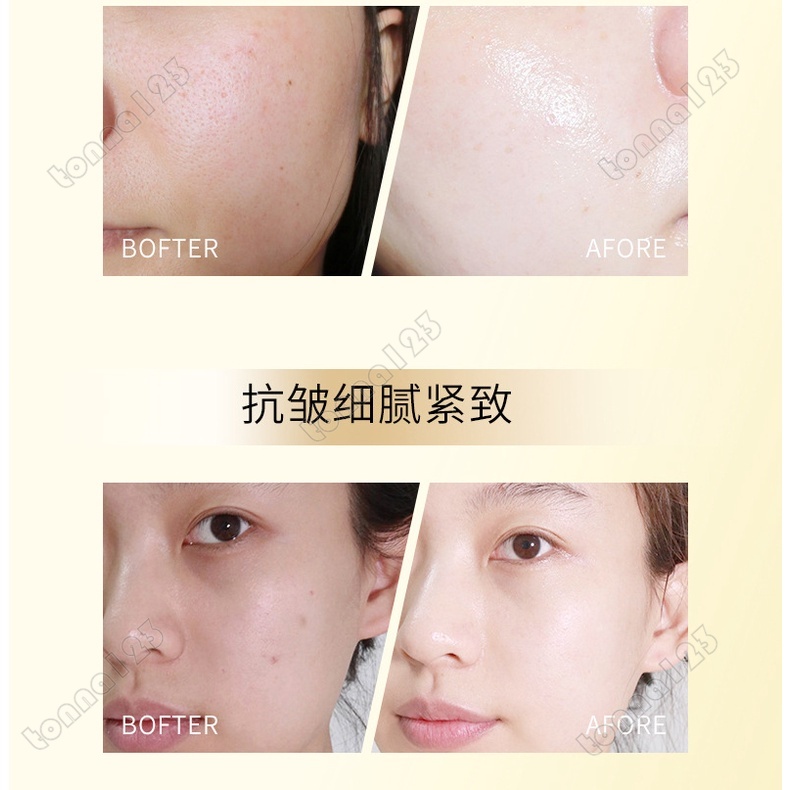 Tinh Chất Retinol HIH Giúp Dưỡng Ẩm Giảm Nếp Nhăn Và Làm Săn Chắc Da Mặt