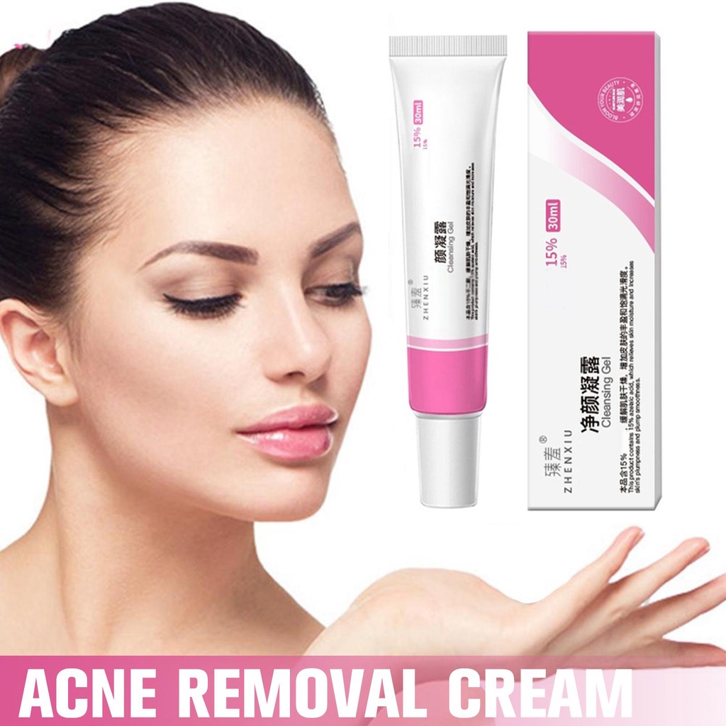 Kem Hỗ trợ giảm mụn Kiểm Soát Dầu Thu Nhỏ Lỗ Chân Lông Chăm Sóc Da Mặt 30ml