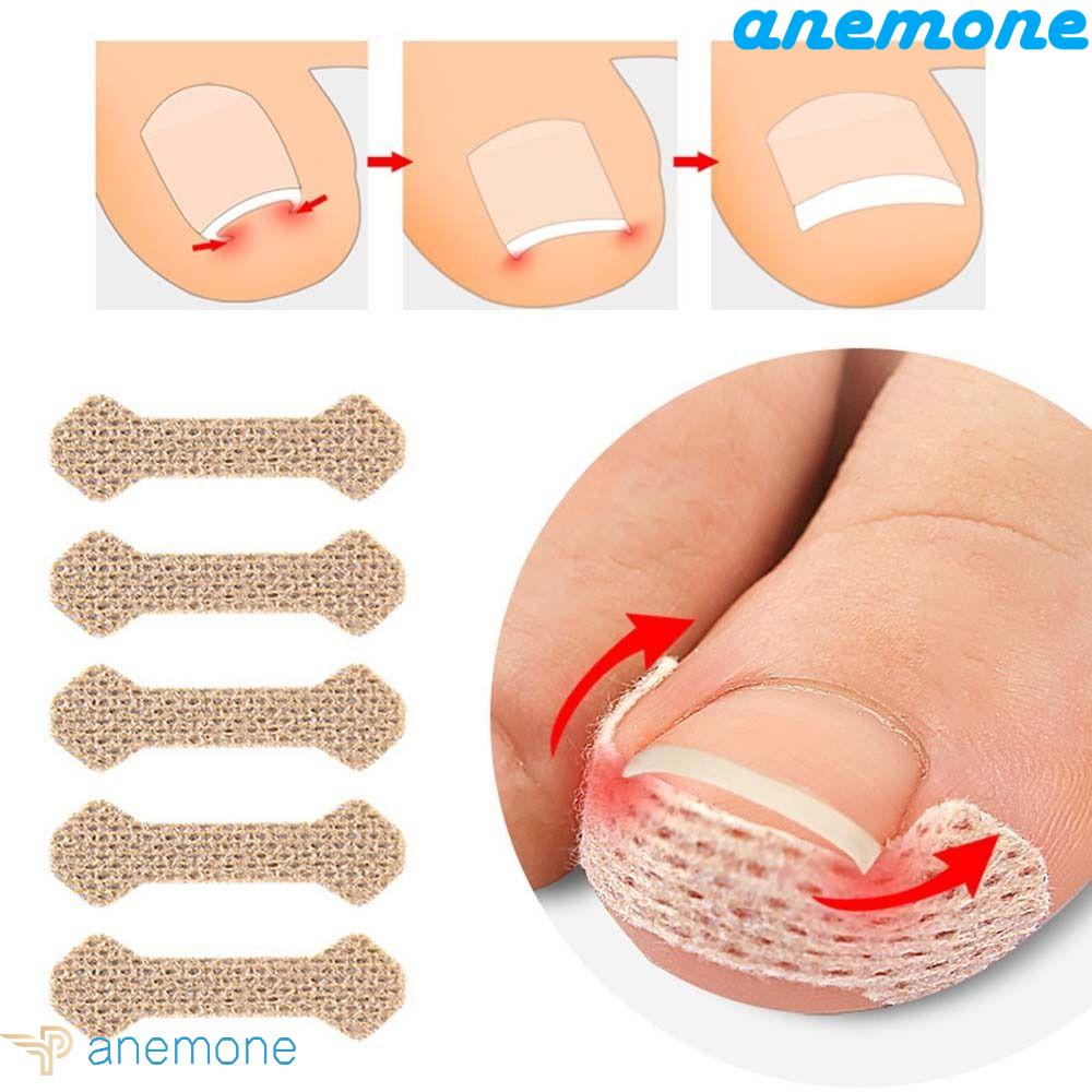 Dụng Cụ Chỉnh Hình Móng Tay ANEMONE