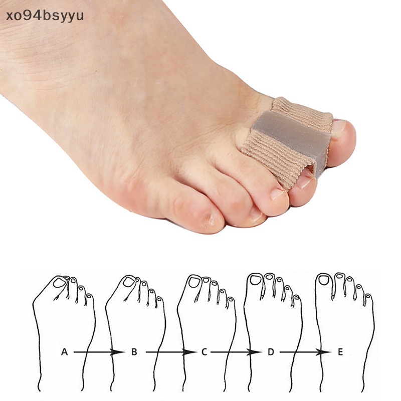 1 Dụng Cụ Tách Ngón Chân Để Giảm Đau Xo94Bsyu Bằng Silicone