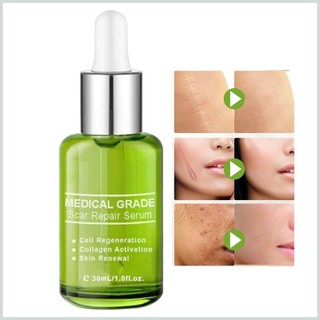 Ô tô xe ô tô cặp đôi 1.0oz có gắn trên xe ô tô có gắn kết xe ô tô có gắn kết xe ô tô có ảnh hưởng đến xe ô tô