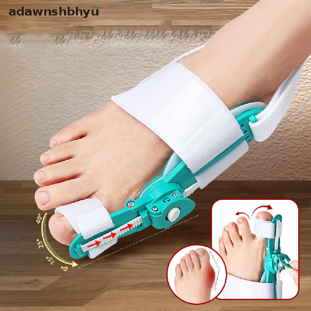 1 Dụng Cụ Nẹp Điều Chỉnh Ngón Chân Cái Bunion