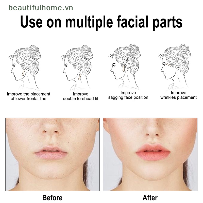 Bộ 60 Miếng Dán Tạo Khuôn Mặt Chữ V Vô Hình