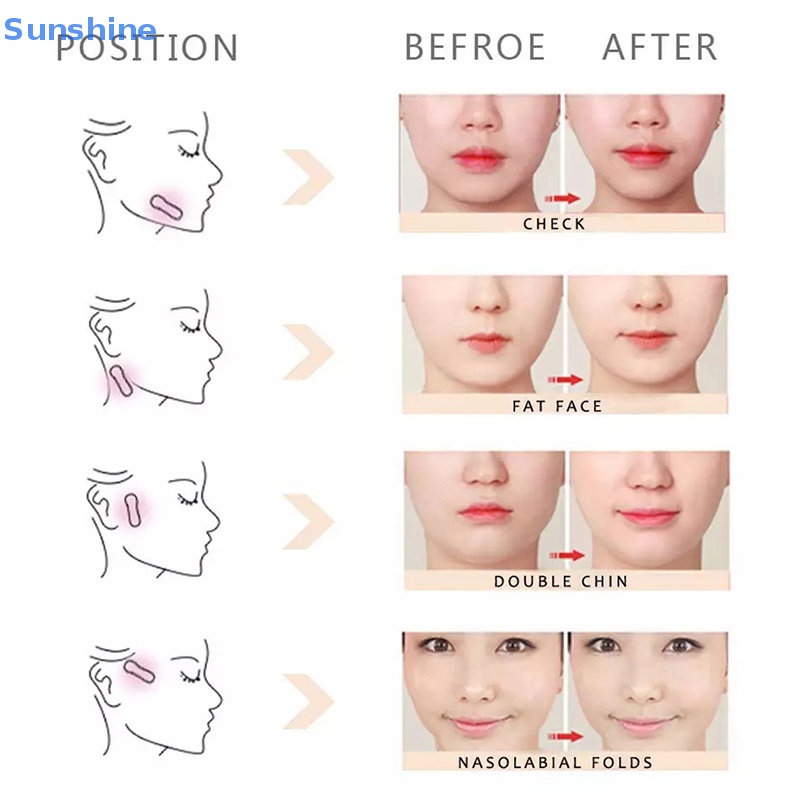 Set 40 Miếng Dán Nâng Mặt Trời Tức Thì Kèm 3 Dây Đeo