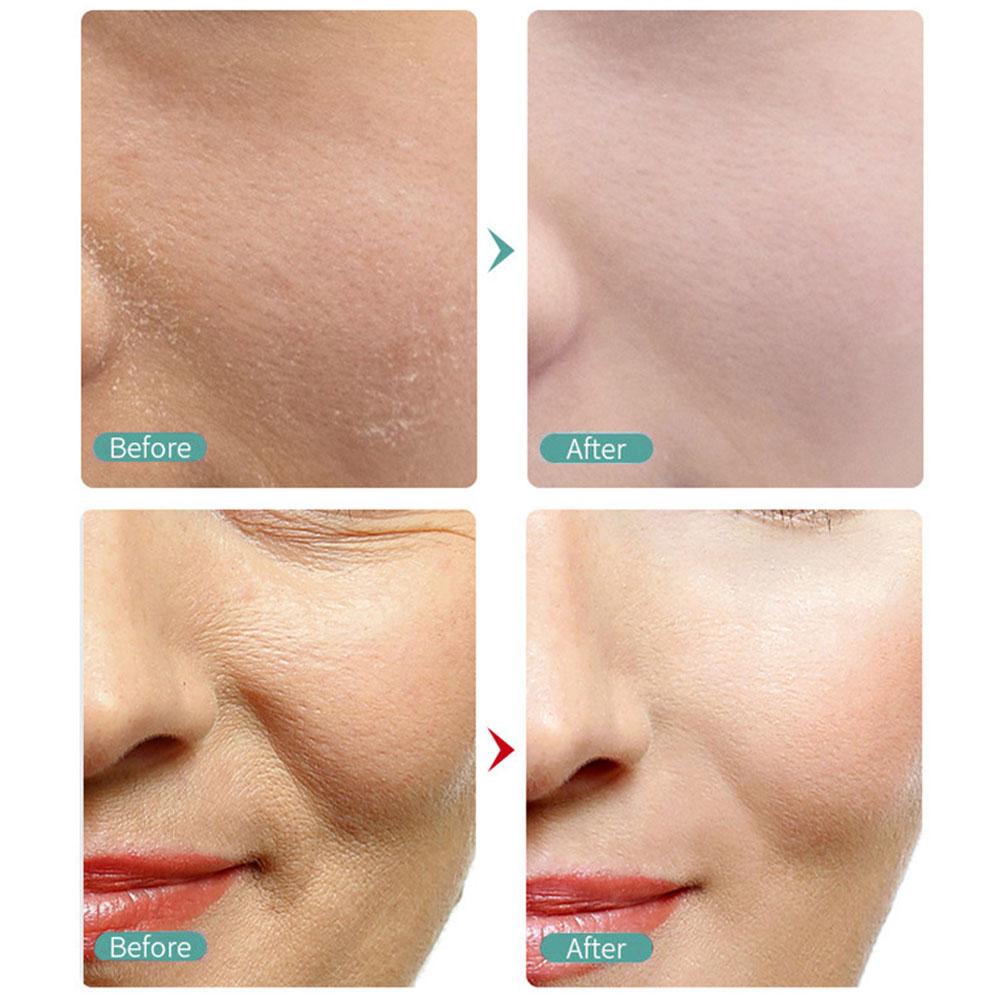 Kem Xóa Nếp Nhăn Tức Thì Chống Lão Hóa Làm Săn Chắc Da Mặt A1W3 20g