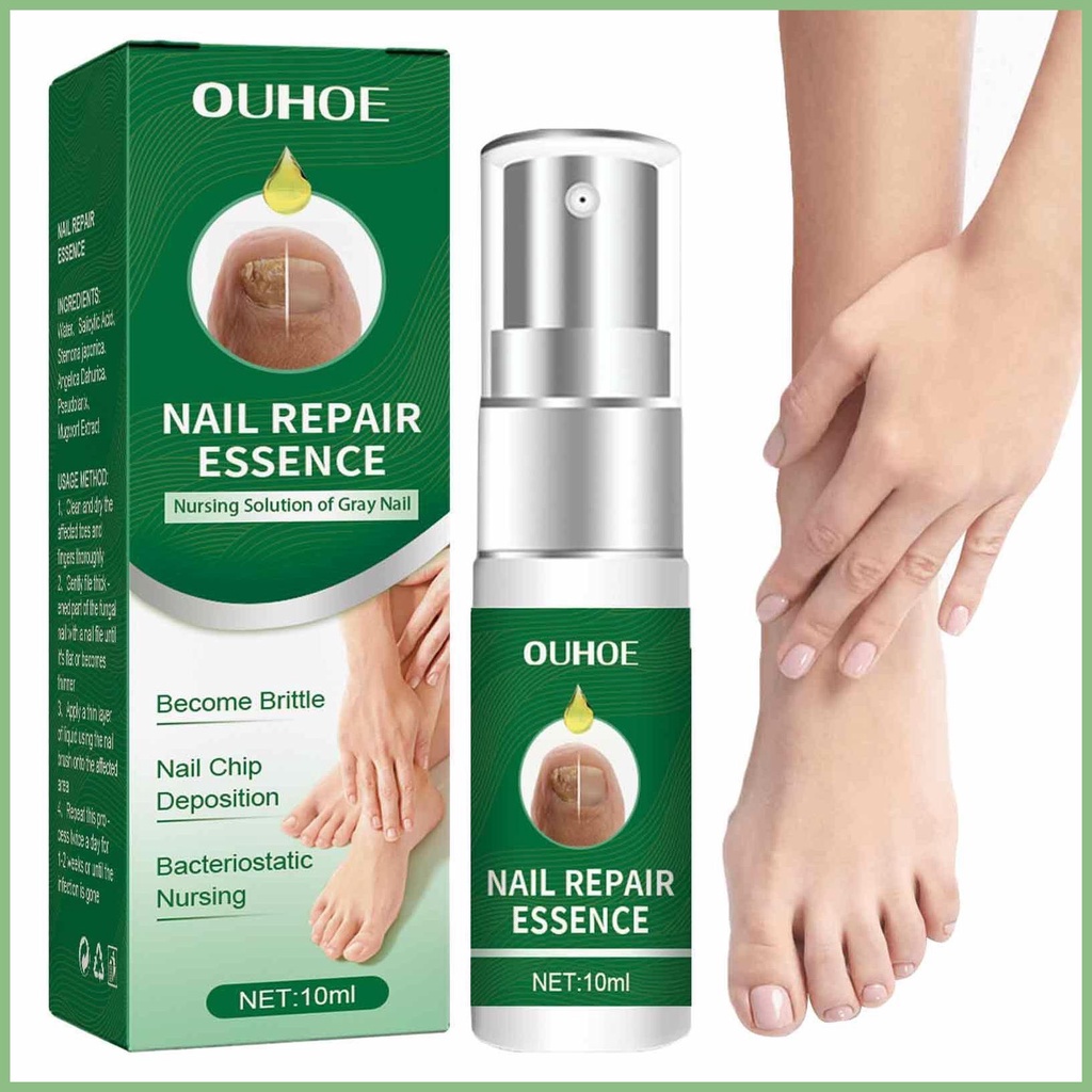 Bộ Dụng Cụ Sửa Chữa Móng Tay Móng Chân Mọc Ngược Đa Năng Tiện Dụng Cho Móng Chân Mọc Ngược Mạnh Mẽ Và Pxu1Vn