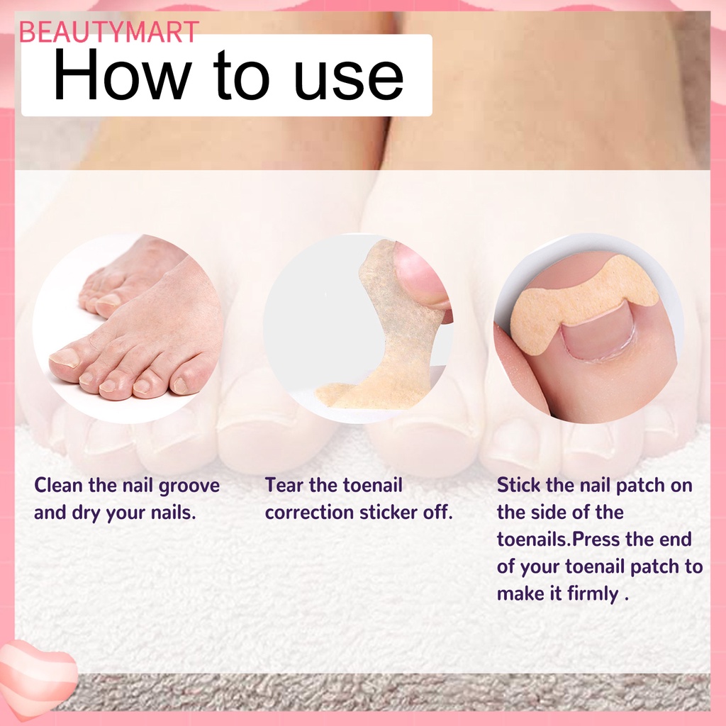 Set 50 Miếng Dán Móng Chân Tự Dính Chống Nước Thoáng Khí Chỉnh Sửa Lỗ Chân