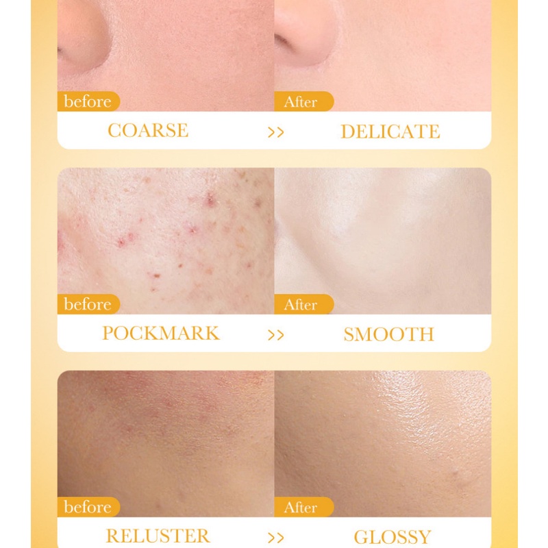 Set 10 Mặt Nạ Bioaqua Vitamin C Làm Sáng Da Kiềm Dầu Loại Bỏ Mụn Đầu Đen Làm Sạch Sâu 8g