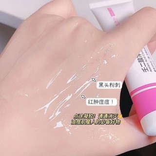 Bán Chạy Đặc Biệt#现货壬二酸凝胶去青春痘收缩毛孔闭口粉刺黑头水杨酸祛痘膏去痘印#正品725yyy...