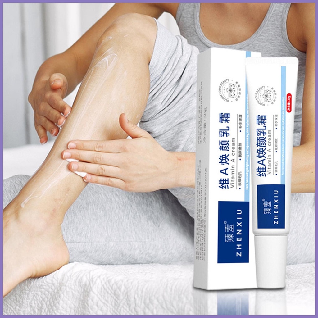 Kem Vitamin A Làm Sáng Da Loại Bỏ Mụn Đầu Đen Trẻ Hóa Và Dưỡng Ẩm nota2vn