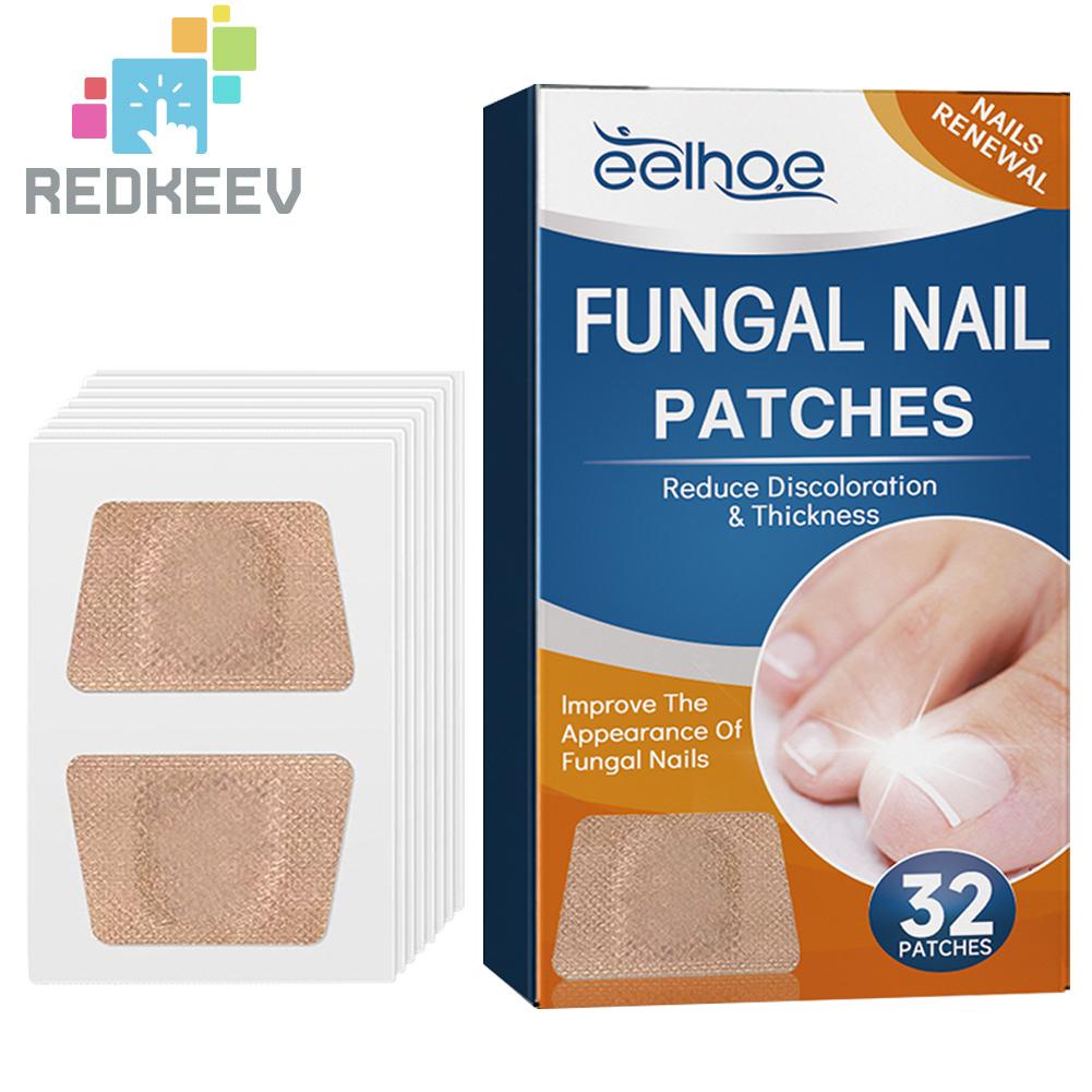 Bộ 32 Miếng Dán Điều Chỉnh Móng Tay Co Giãn Thoáng Khí Dễ Sử Dụng