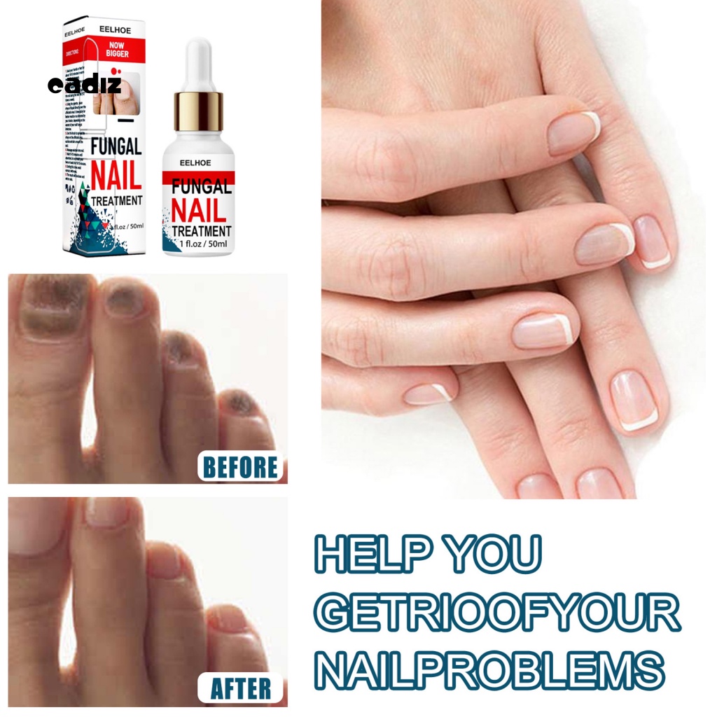 Tinh Dầu Chăm Sóc Móng Tay Bị Hư Tổn Đa Năng Tiện Lợi Dành Cho Salon