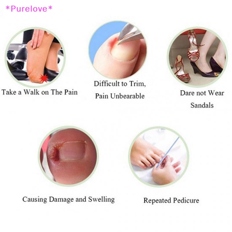 Set 10 Miếng Dán Chỉnh Sửa Móng Chân Tiện Dụng Mới