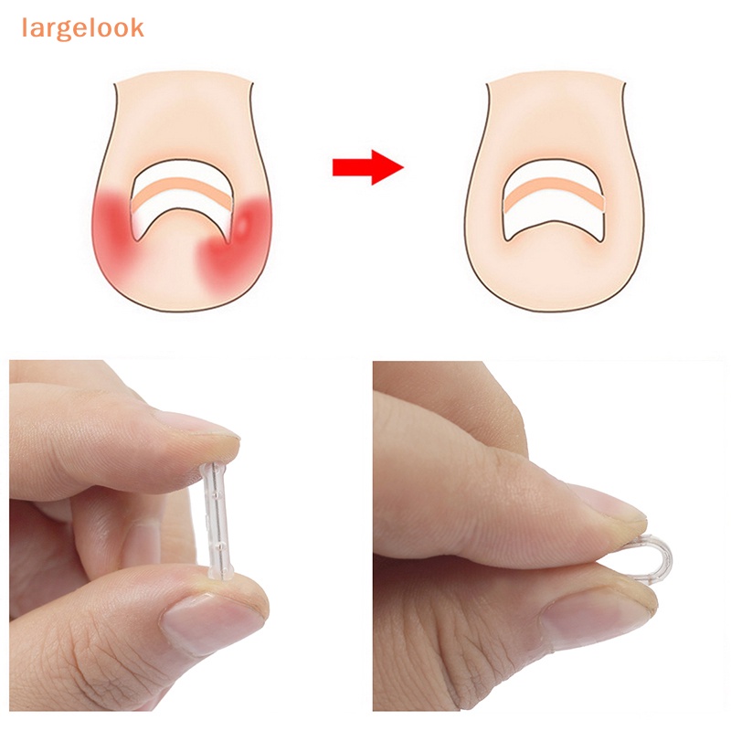 Bộ 10 Miếng Dán Chỉnh Sửa Móng Chân 13-20mm