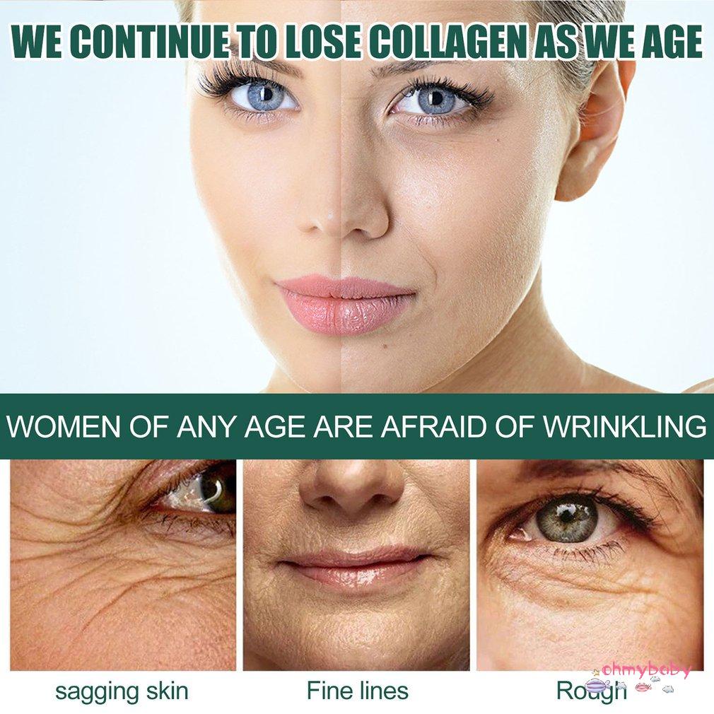 [Ready] Tác dụng chống lão hóa tuyệt vời Quầng thâm Làm sáng da Dưỡng ẩm Ingridiends Tinh chất nhăn sâu [Z/2]