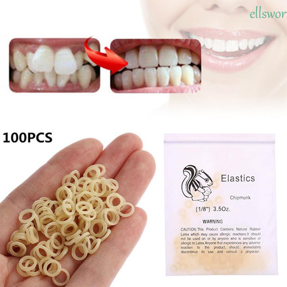 Túi 100 Vòng Cao Su Chỉnh Hình Răng