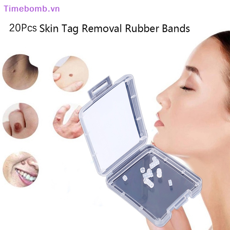 # Túi Đeo Chéo Thời Trang Hàn Cho Nữ # Set 20 Dây Cao Su Loại Bỏ Mụn Cóc Không Độc Hại Chăm Sóc Da Mặt